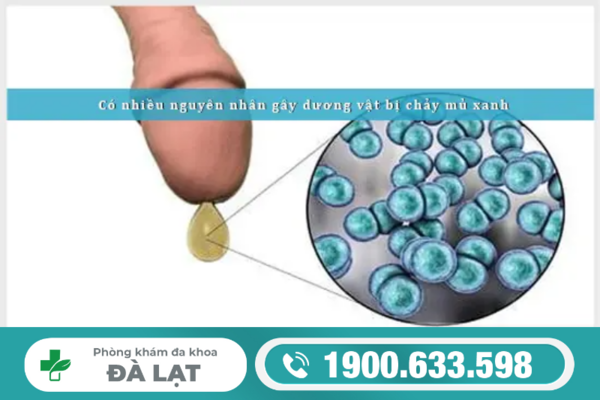 Hình ảnh minh họa